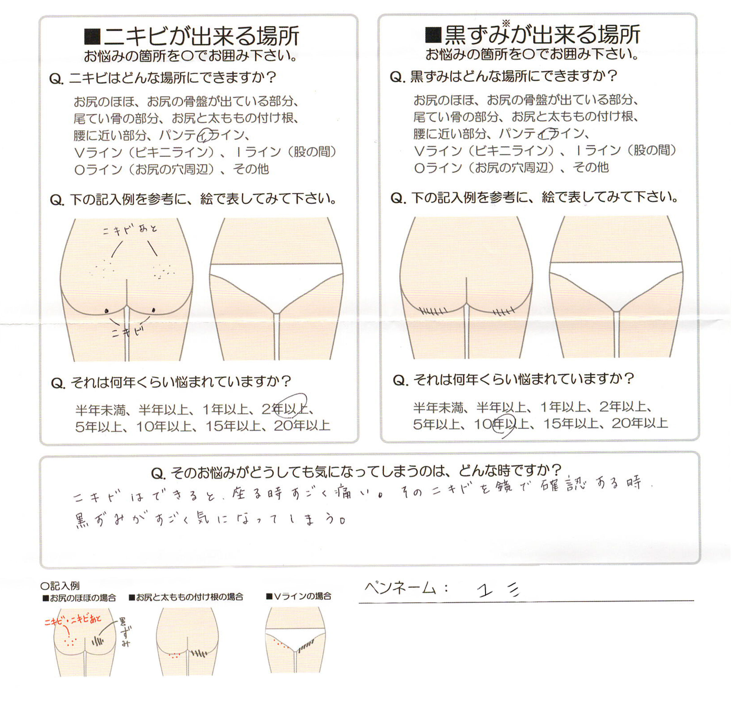 気になっている部位アンケート 愛知県 ユミ様 37歳 ピーチローズ公式ショッピングサイト 気になっている部位アンケート 愛知県 ユミ様 37歳 ピーチローズ公式ショッピングサイト
