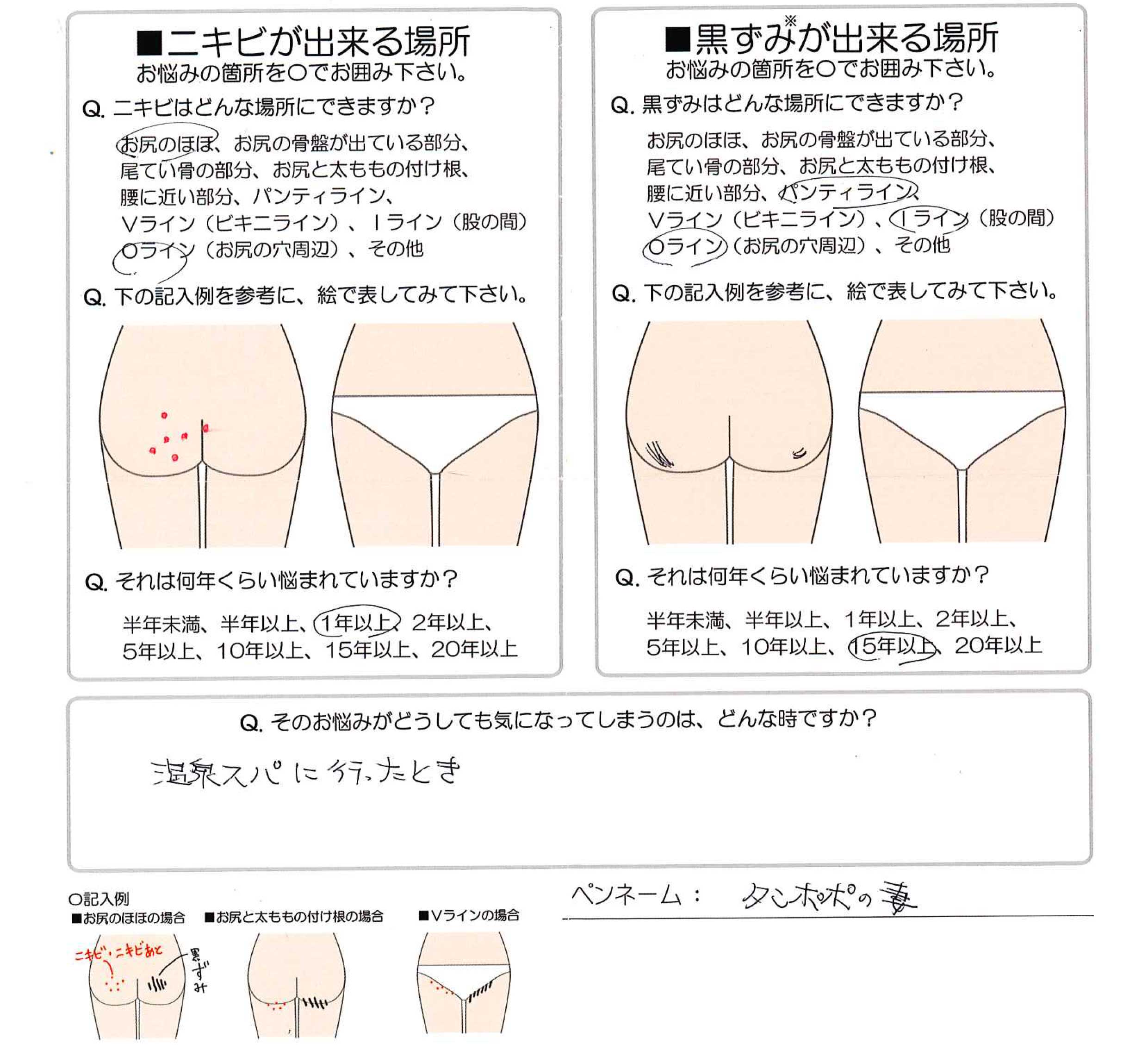 妻のお尻の穴 