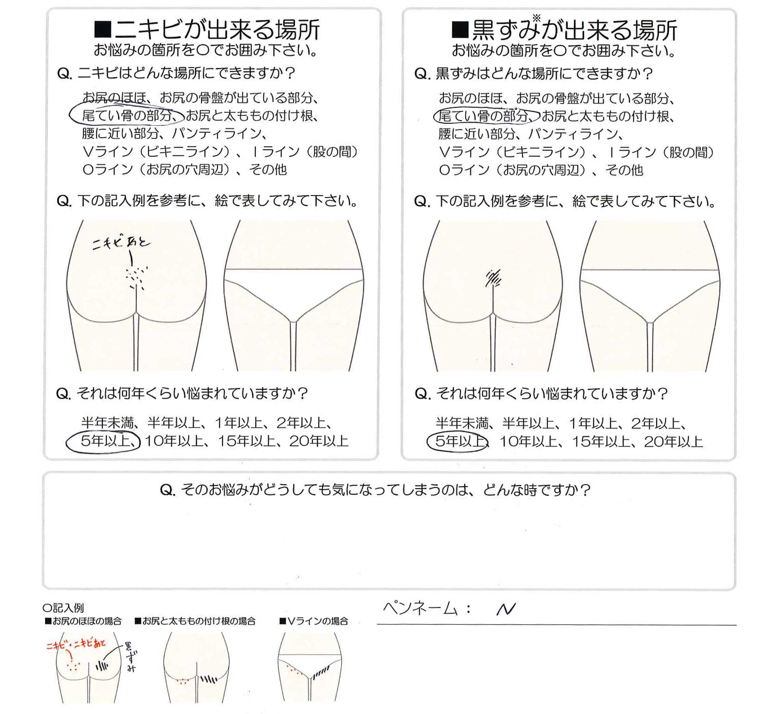 黒ずみ 尾てい骨 意外と知らない「床ずれ」その予防と治療について